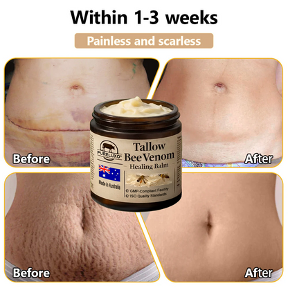 🇦🇺【70% OFF Wraps Up Today】Pureluxo® 🐄Tallow Bee Venom Healing Balm（Sorts Out Spots, Wrinkles & Knackered Skin — Steroid-Free）