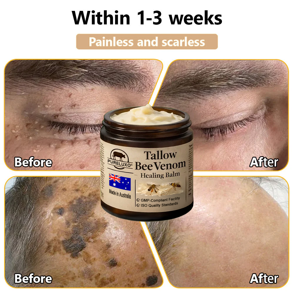 🇦🇺【70% OFF Wraps Up Today】Pureluxo® 🐄Tallow Bee Venom Healing Balm（Sorts Out Spots, Wrinkles & Knackered Skin — Steroid-Free）