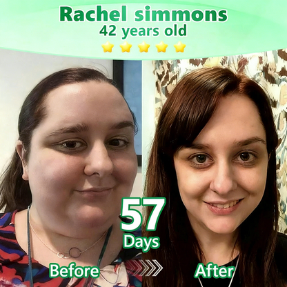 【🇦🇺𝐿𝑎𝑠𝑡 𝐷𝑎𝑦 𝑃𝑟𝑜𝑚𝑜𝑡𝑖𝑜𝑛 70% 𝑂𝐹𝐹】|𝙋𝙪𝙧𝙚𝙡𝙪𝙭𝙤® 𝑴𝒐𝒓𝒊𝒏𝒈𝒂 & 𝑩𝒆𝒓𝒃𝒆𝒓𝒊𝒏𝒆 *NAD+| Slimming & Firming 2-in-1 Nano Microneedle Patch|𝘉𝘢𝘤𝘬𝘦𝘥 𝘣𝘺 𝘴𝘤𝘪𝘦𝘯𝘤𝘦 | 10-𝗂𝗇-𝟣 𝖿𝗈𝗋𝗆𝗎𝗅𝖺 | 𝑅𝑒𝑠𝑢𝑙𝑡𝑠 𝑖𝑛 7 𝑑𝑎𝑦𝑠 ⏳