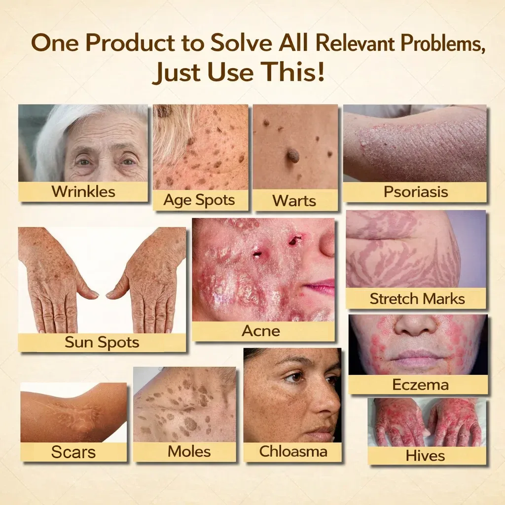 🇦🇺【70% OFF Wraps Up Today】Pureluxo® 🐄Tallow Bee Venom Healing Balm（Sorts Out Spots, Wrinkles & Knackered Skin — Steroid-Free）