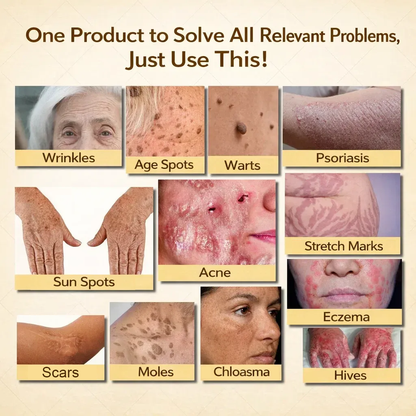 🇦🇺【70% OFF Wraps Up Today】Pureluxo® 🐄Tallow Bee Venom Healing Balm（Sorts Out Spots, Wrinkles & Knackered Skin — Steroid-Free）