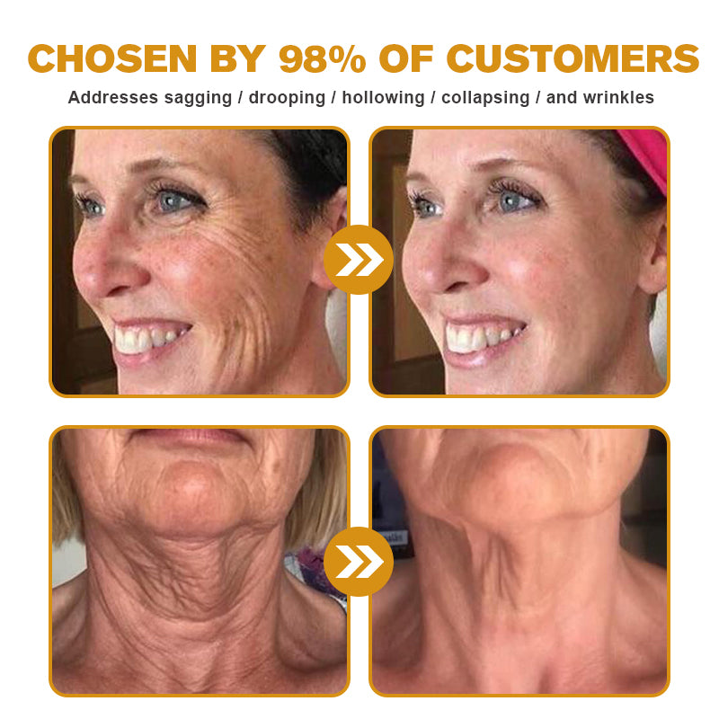 🧑‍⚕️Pureluxo® Botox Bee Venom Wrinkle Removal Cream- LAST DAY 70% OFF🔥