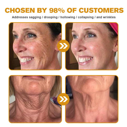 🧑‍⚕️Pureluxo® Botox Bee Venom Wrinkle Removal Cream- LAST DAY 70% OFF🔥