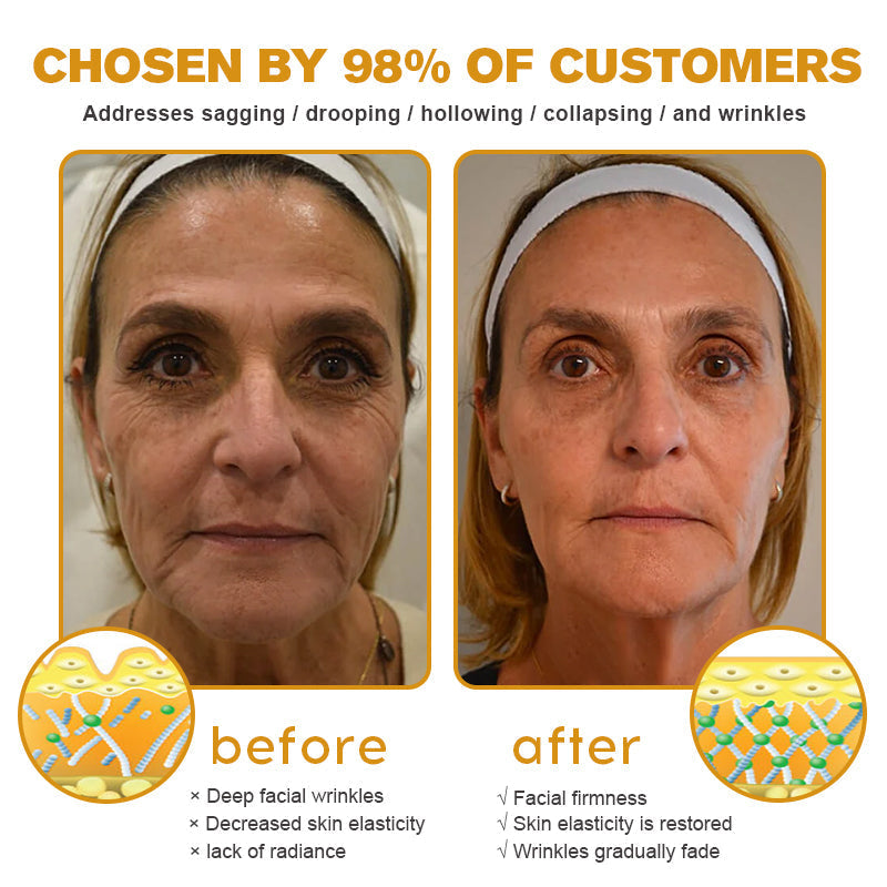 🧑‍⚕️Pureluxo® Botox Bee Venom Wrinkle Removal Cream- LAST DAY 70% OFF🔥
