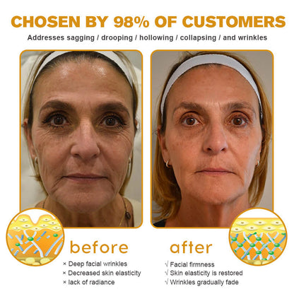 🧑‍⚕️Pureluxo® Botox Bee Venom Wrinkle Removal Cream- LAST DAY 70% OFF🔥